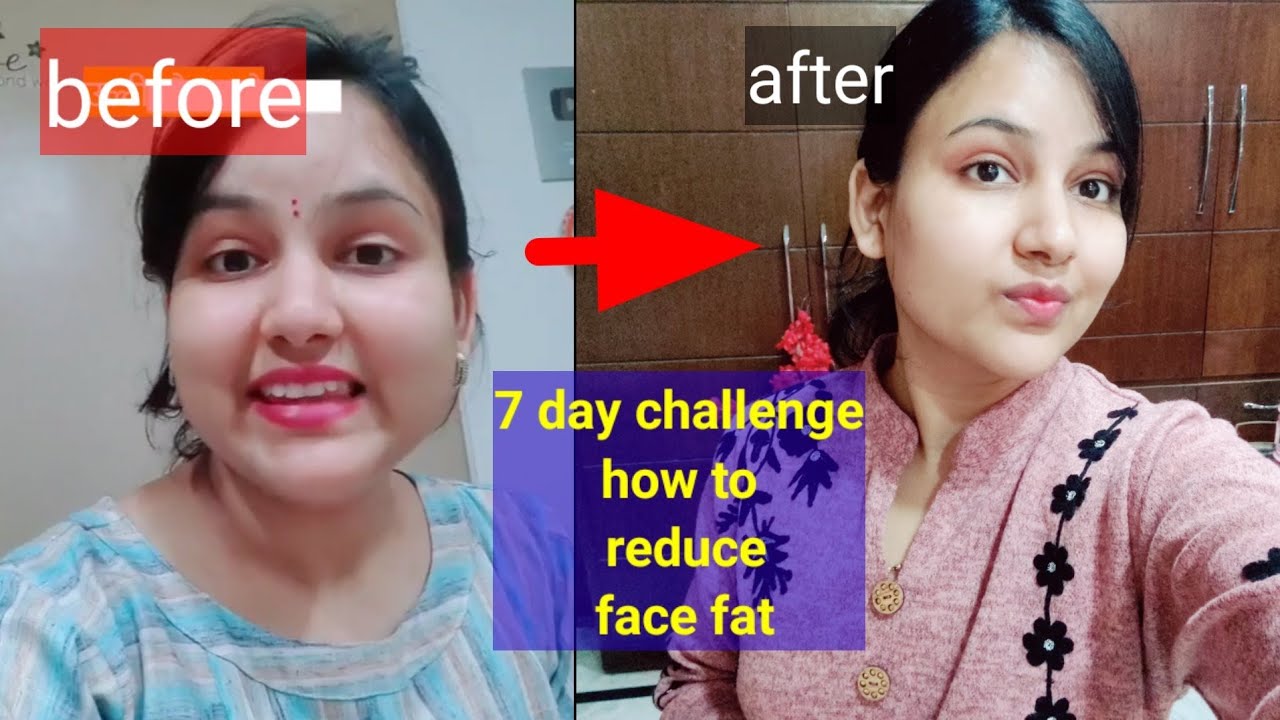How to reduce face fat at home  / चेहरे का मोटापा कैसे कम करे चेहरे को पतला करने का तरीका #facefat