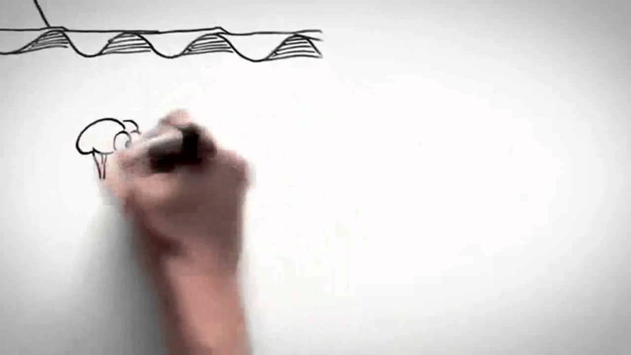 Vídeo explicativo sobre Dolor Crónico