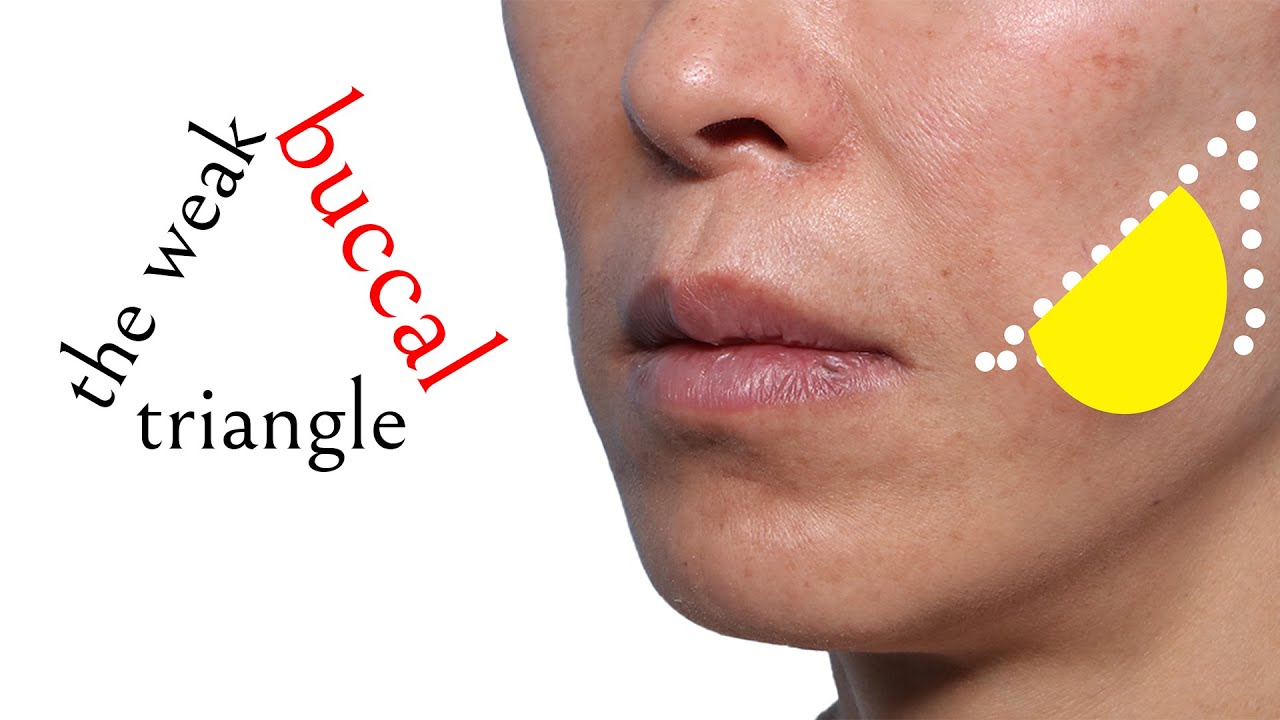Where does the buccal fat pad live?  Understanding the anatomy of the buccal space with Dr. Zelken