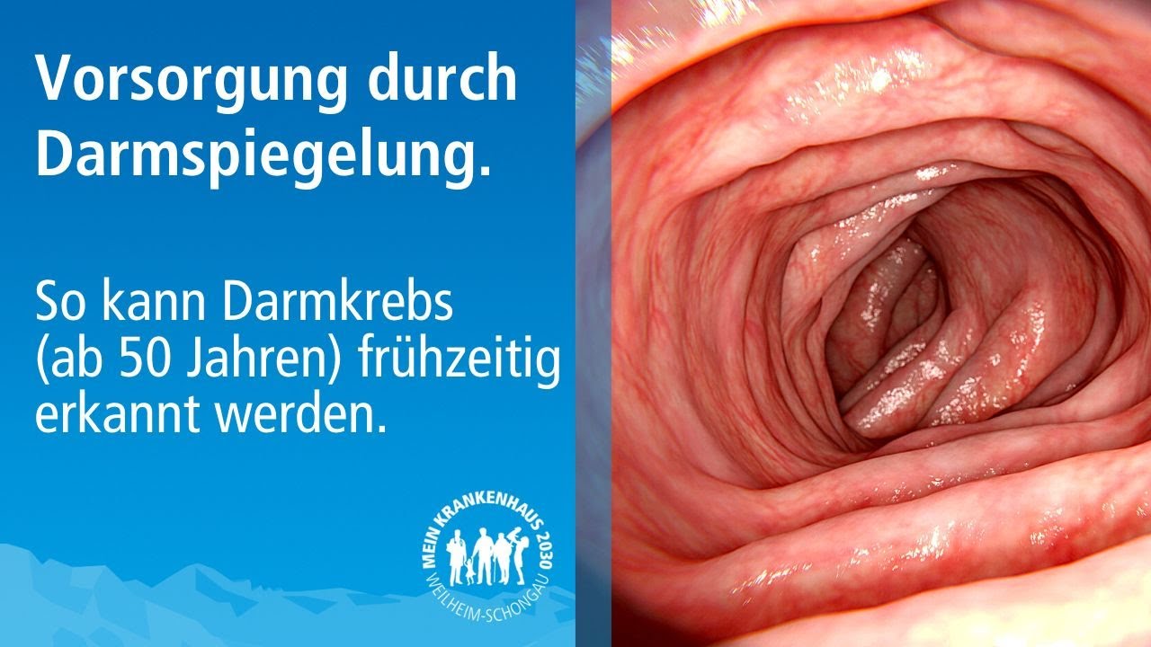 Koloskopie: So bereiten Sie sich richtig auf eine Darmspiegelung vor.