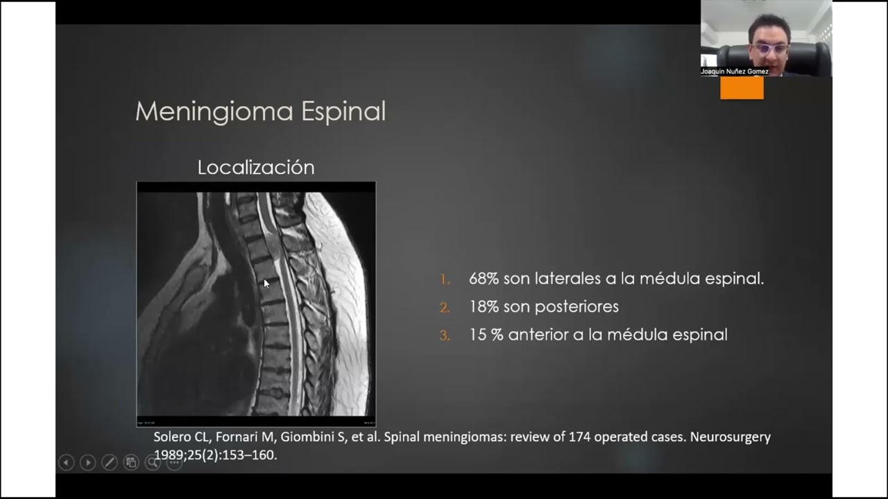 SPINE WEBINAR 42. DIAGNOSTICO RADIOLOGICO DE LESIONES TUMORALES DE COLUMNA.