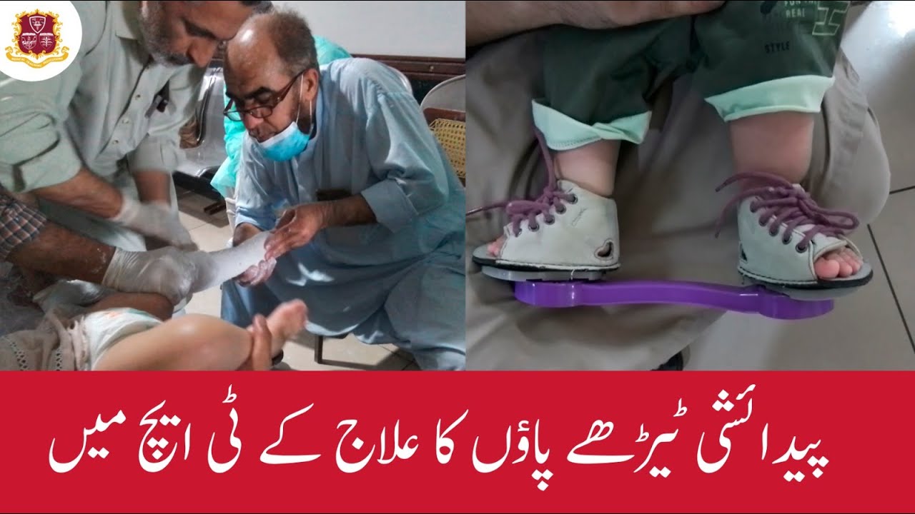 Clubfoot Seminar | 19th October 2023 | Associate Prof. Sikandar Hayat | Orthopaedic Department - KTH