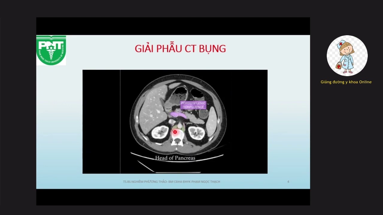 CT BỤNG CẤP | TS. BS. NGHIÊM PHƯƠNG THẢO