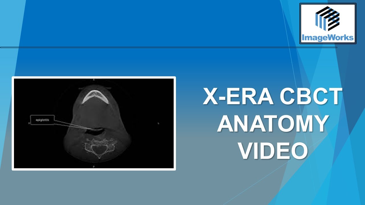 X-era CBCT Anatomy Video