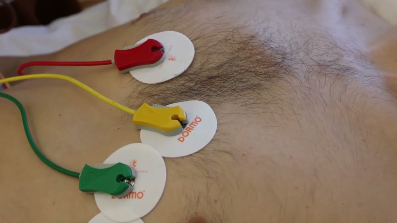 EKG přiložení svodů