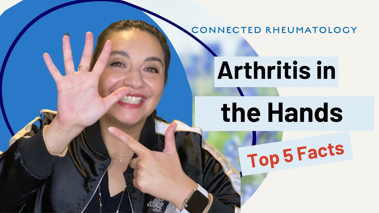 Артрит рук // Пять главных фактов, которые нужно знать при артрите рук