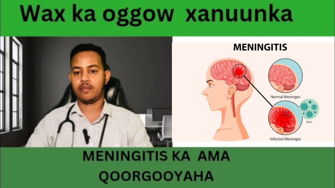 Xanuunka Meningitis / Qoor Gooye ama Majaajiska . ( Dr. Ayanle Ali Mohamoud )