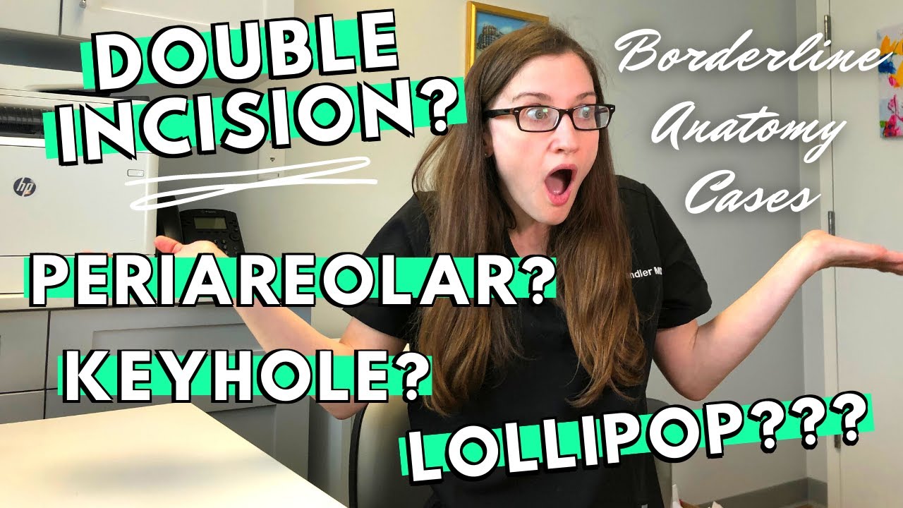 Top Surgery - Double Incision vs. Peri/Keyhole // Plastic Surgeon Explains Borderline Anatomy Cases