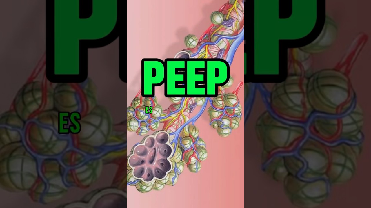 Ventilaci&oacute;n mec&aacute;nica #PEEP 🫁