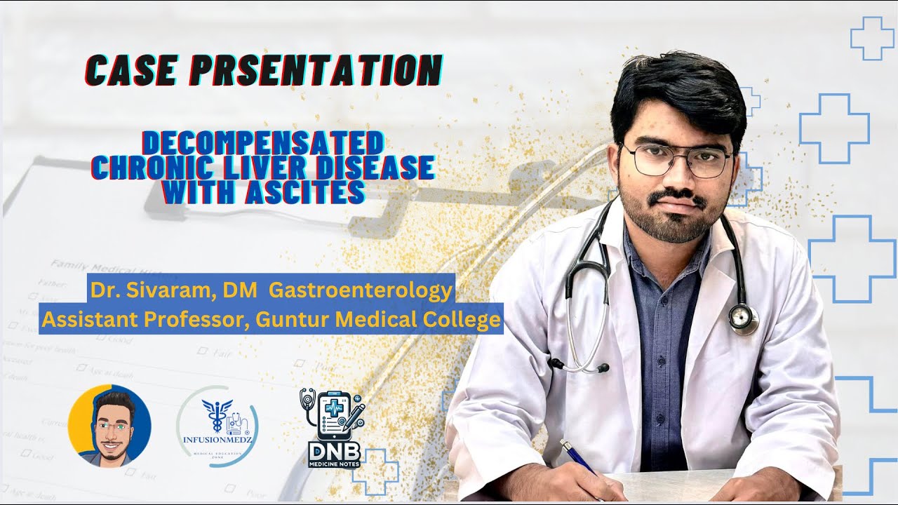 Case Presentation | Chronic Liver Disease | Post Graduate General Medicine
