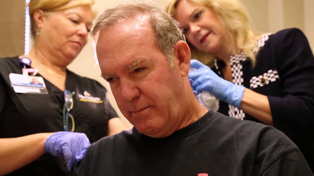 Hair Transplant Surgery: Richard&rsquo;s Story