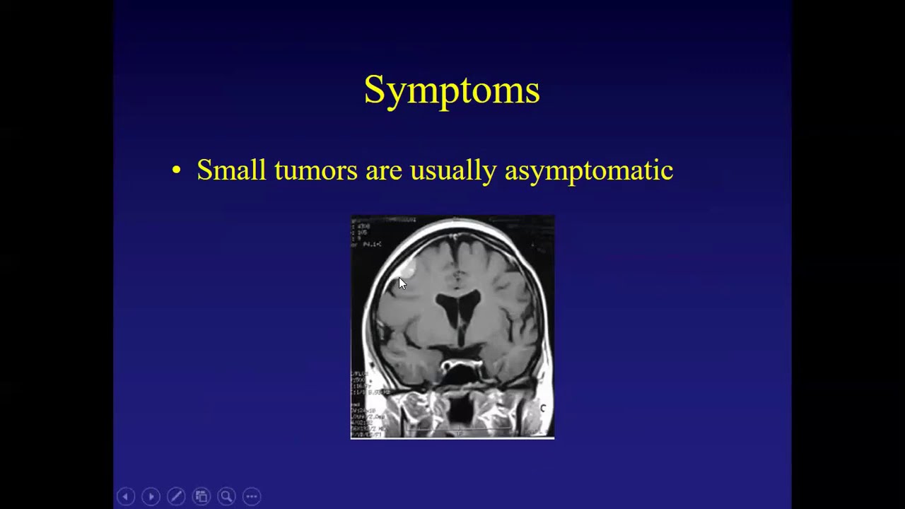 Какие менингиомы не следует лечить