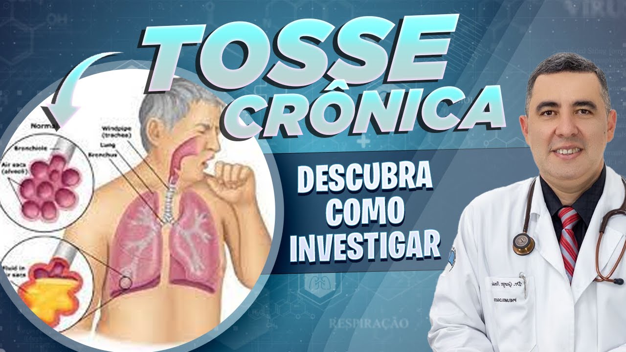 PNEUMOLOGISTA explica como a TOSSE CR&Ocirc;NICA deve ser INVESTIGADA