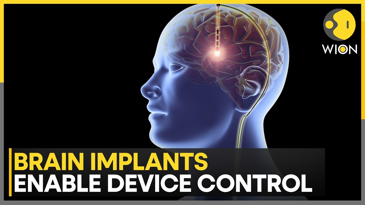 Neuralink Launches First UK Brain Chip Trial: Musk&rsquo;s Mind-Control Tech Debuts In Britain | WION
