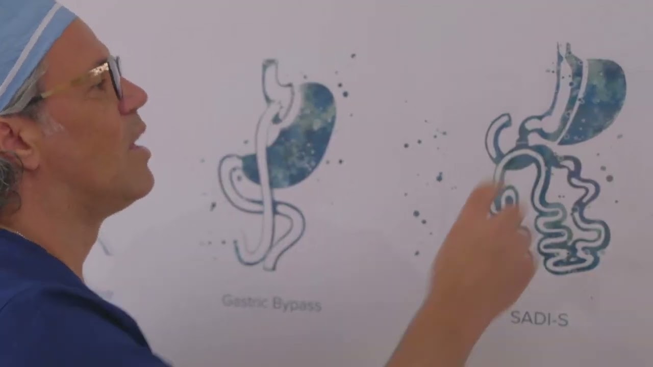 A Look at Our Popular Bariatric Surgeries