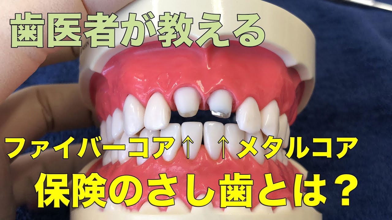 さし歯の治療法の説明