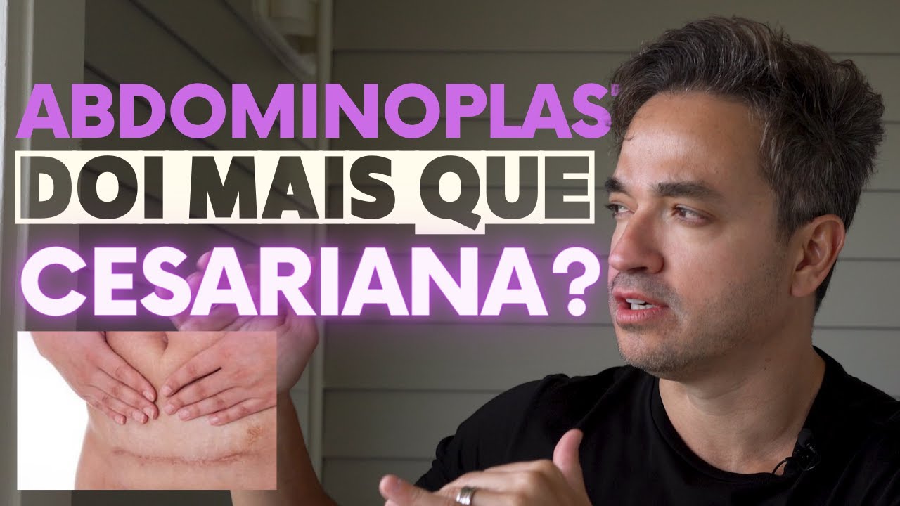 ABDOMINOPLASTIA DÓI MAIS QUE CESÁRIA?