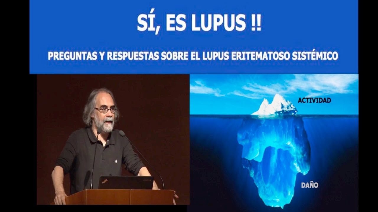 Los 10 mandamientos en el Lupus Eritematoso sistémico | Guillermo Ruiz-Irastorza