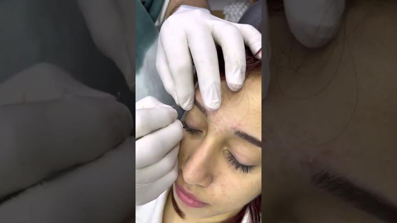Kaş piercing işlemi #piercings #tattoo #gebze #piercing #tattoos #tattoos #ibrahimuzunoğlu