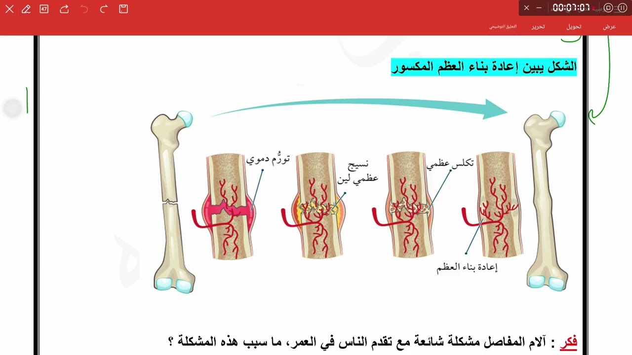 الجهاز الهيكلي ج3 // أسئلة مثيرة للتفكير الوحدة الأولى 