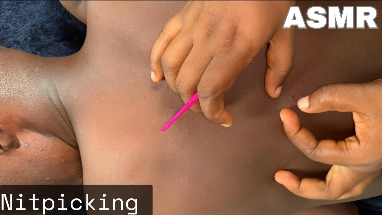 ASMR Nitpicking for Sleep