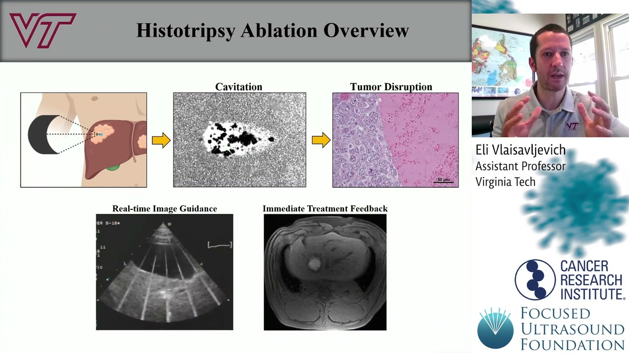 Cancer Immunotherapy Workshop 2021 – Overview of Different Focused Ultrasound Modalities