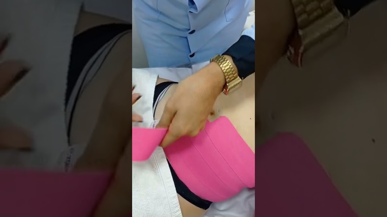 Taping no Transoperat&oacute;rio