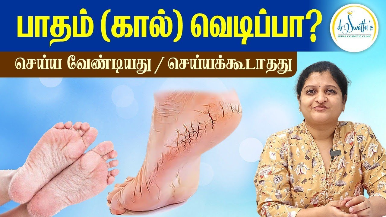 பாதம் (கால் ) வெடிப்பா ? | Fissure Feet problem in Tamil | Kal Vedippu Treatment | Dr Swathika