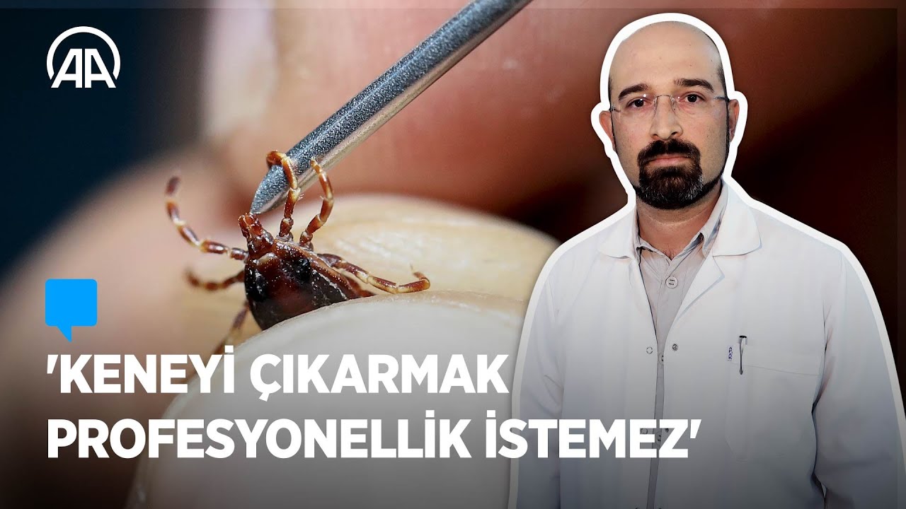 Kene nasıl çıkarılmalı?