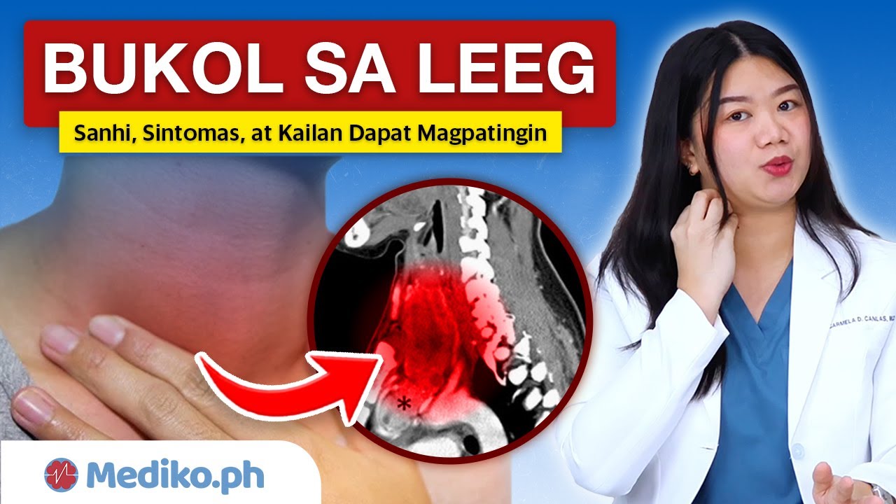 BUKOL SA LEEG: Sanhi, Sintomas, at Kailan Dapat Magpatingin