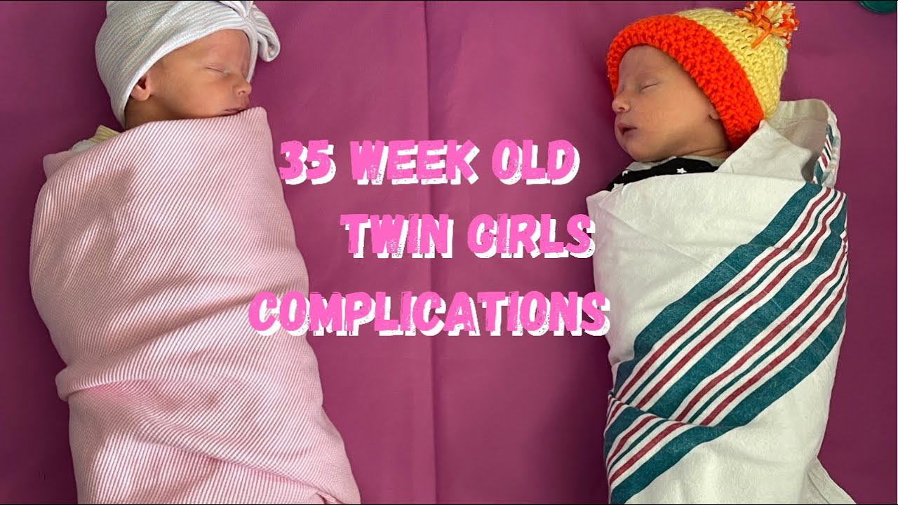 TWIN GIRLS BORN AT 35 WEEKS! OUR STORY.....