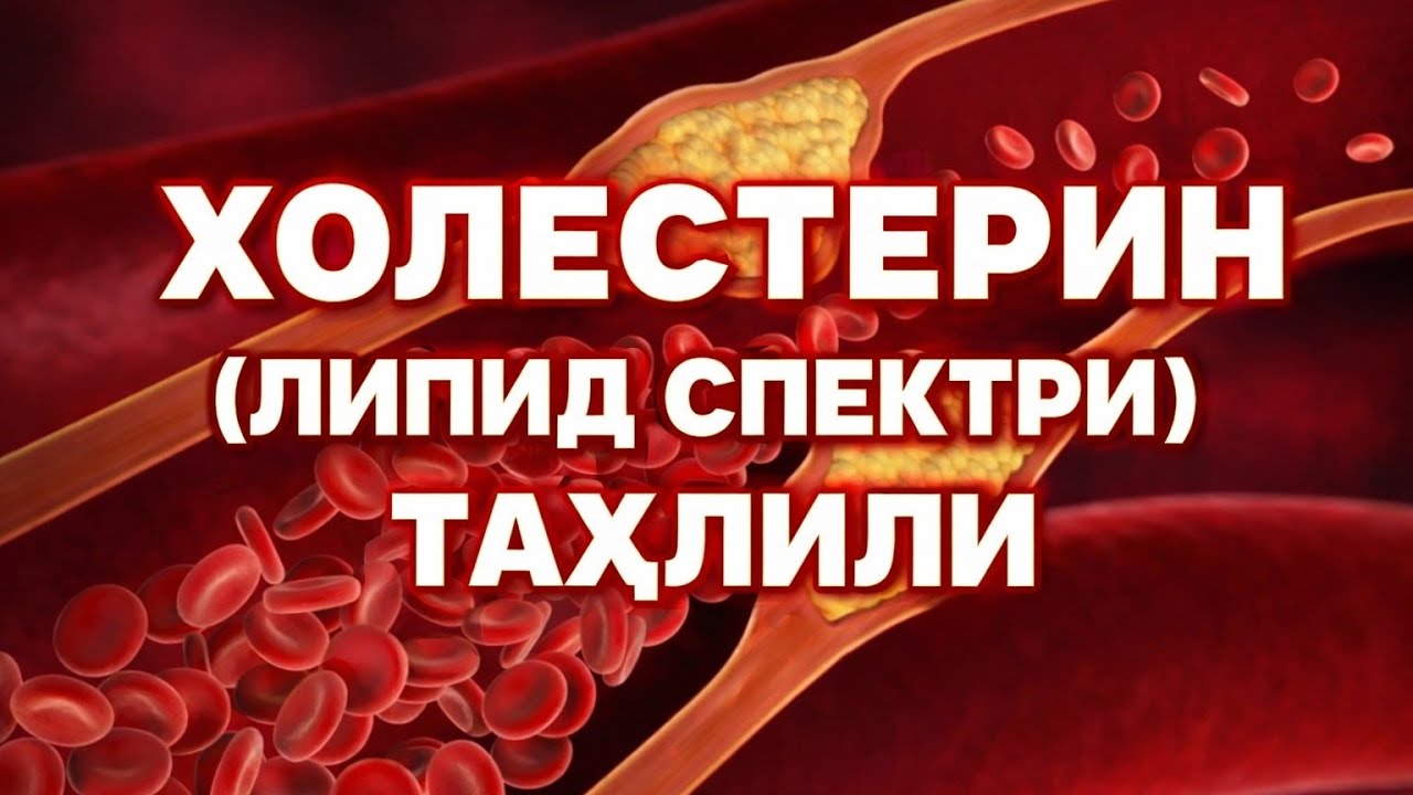ХОЛЕСТЕРИН (ЛИПИД СПЕКТРИ) ТАҲЛИЛИ