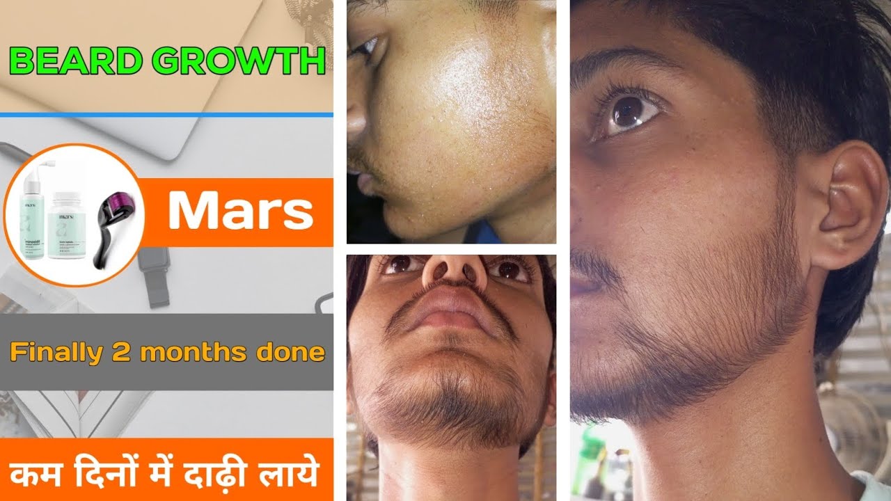 BEARD GROWTH ! कम दिनों में दाढ़ी लाये - Finally 2 months done ! Grow a beard in less days