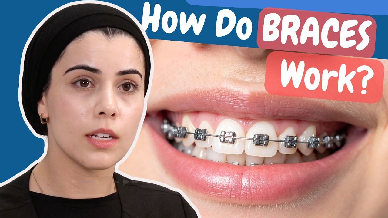 How do braces work?