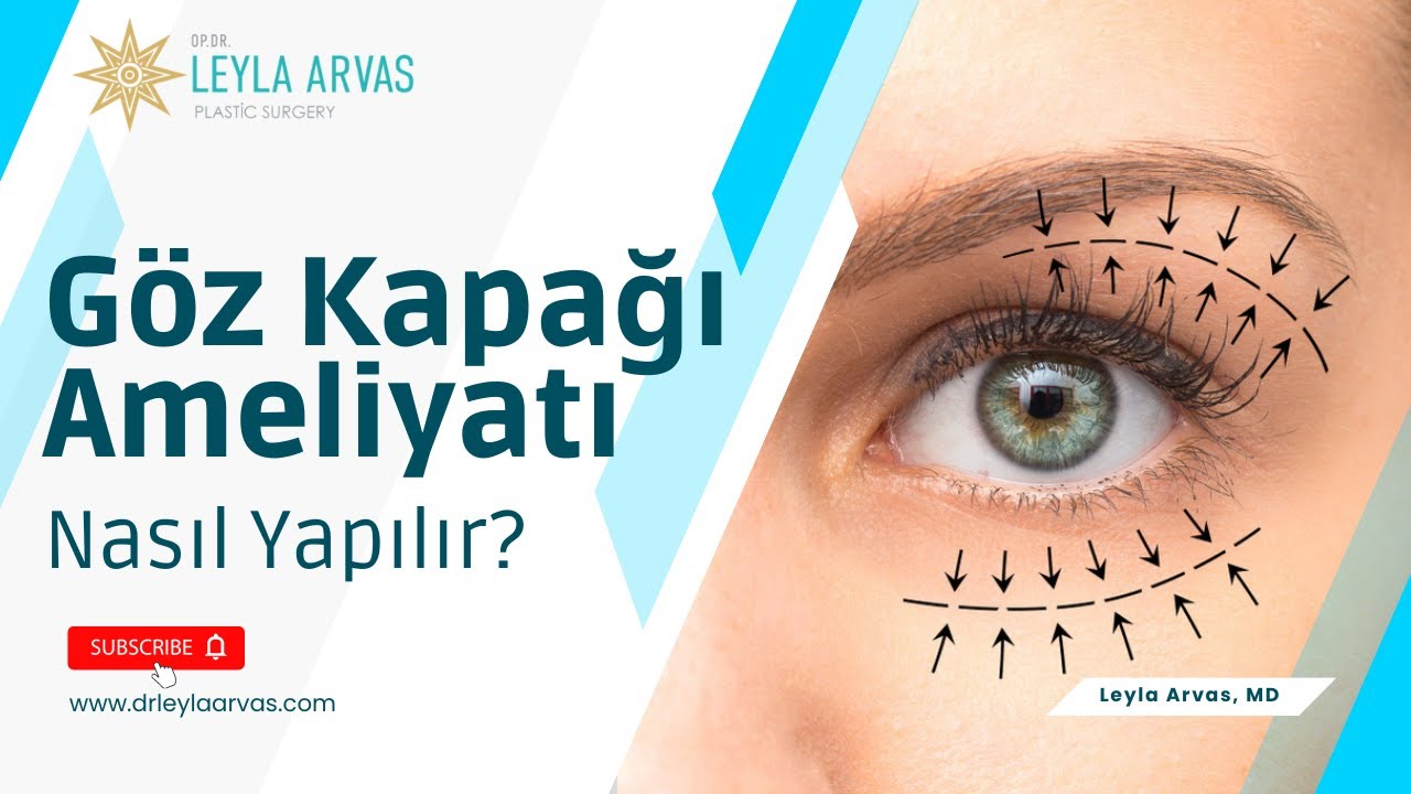 Göz Kapağı Ameliyatı Nasıl Yapılır? | Göz Kapağı Düşüklüğü Nasıl Giderilir? | Op. Dr. Leyla Arvas