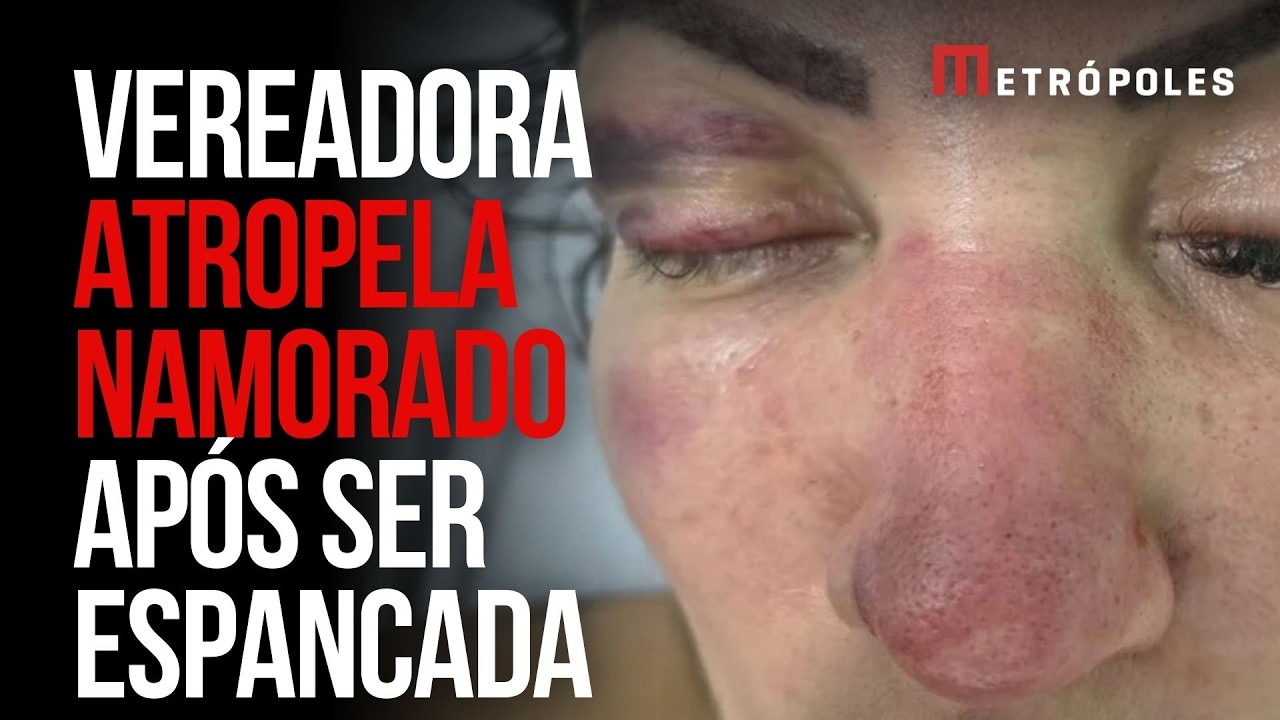 Vereadora em SP atropela namorado ap&oacute;s ser espancada por ele