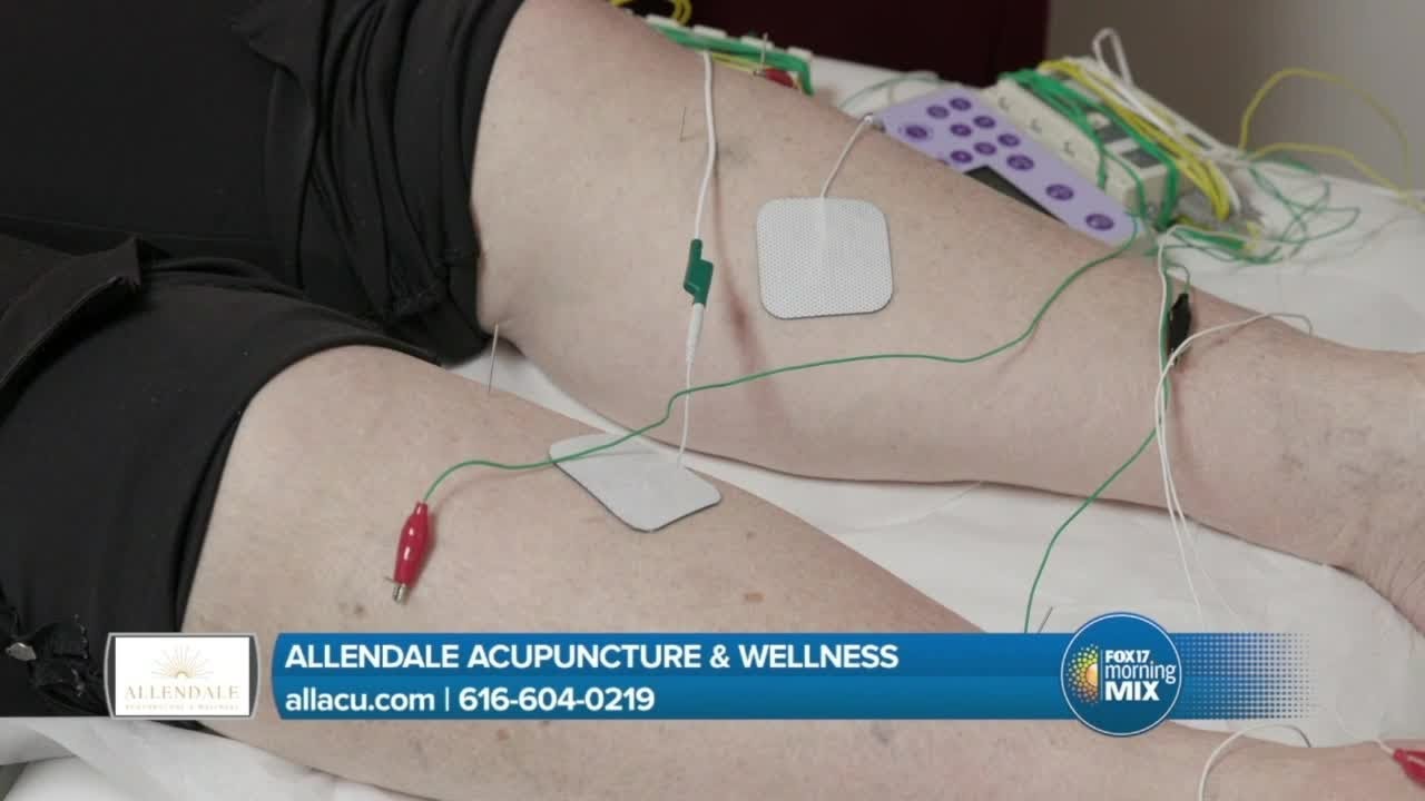 Allendale Acupuncture heals chronic conditions including neuropathy (sponsored)