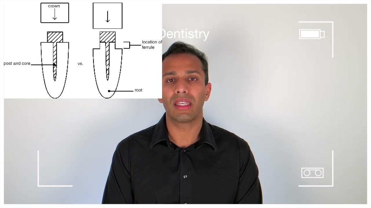 Dental Crown Lengthening