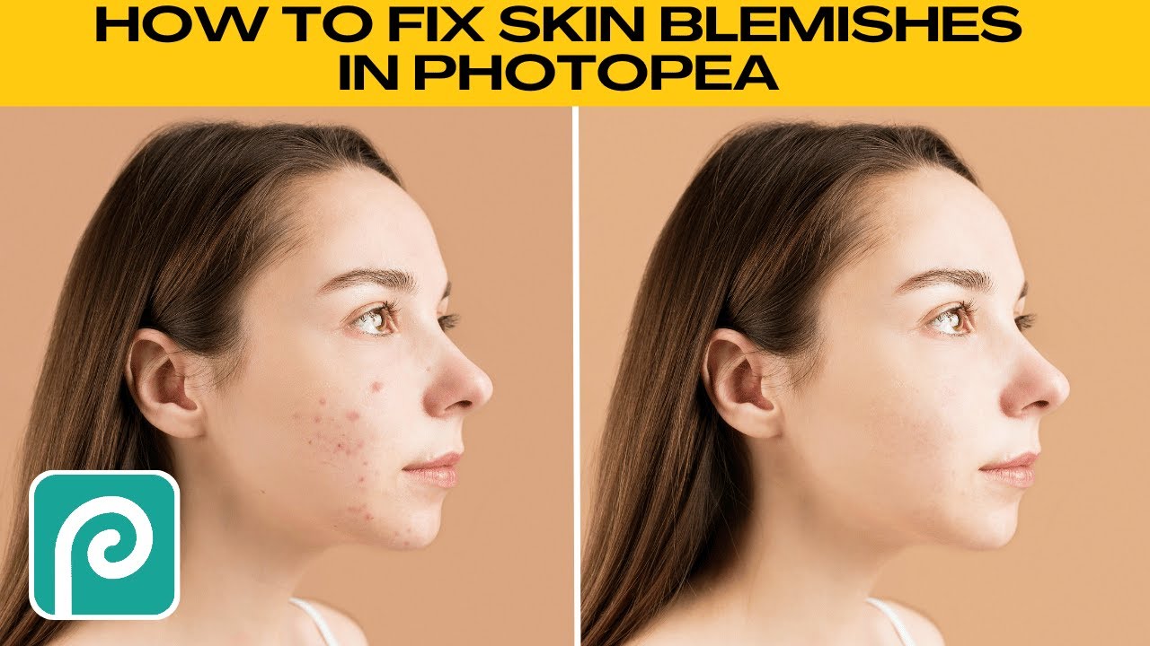 How to Remove Skin Blemishes Easily in Photopea! (Remove Acne, Pimples, Freckles, Scars, etc.)