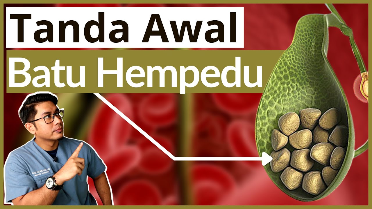Batu Karang Hempedu | 5 Tanda Awal Wajib Tahu | Doctor Sani |