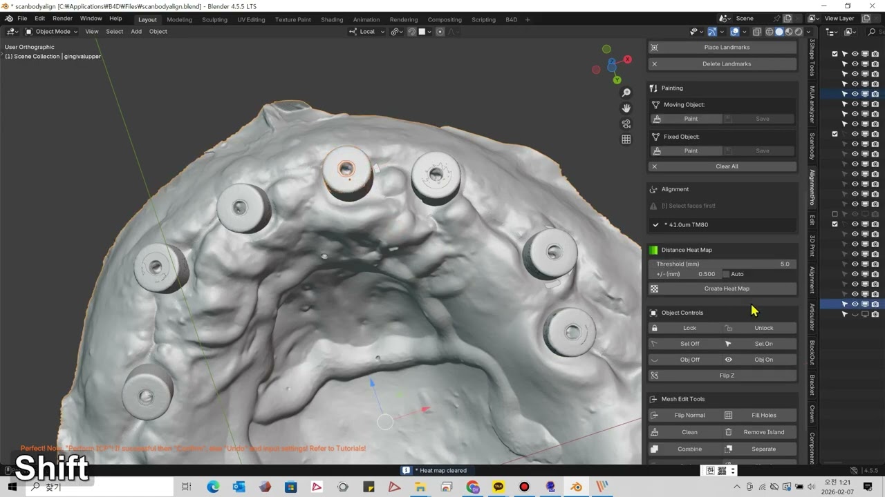 Dental ICP Pro 2-Click Alignment