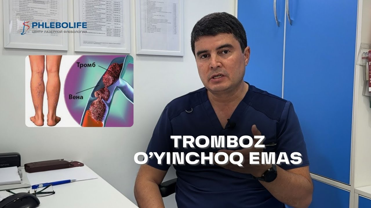 TROMBOZ NIMAGA OLIB KELADI | 25 yillik ILMIY FLEBOLOGdan to'liq JAVOB
