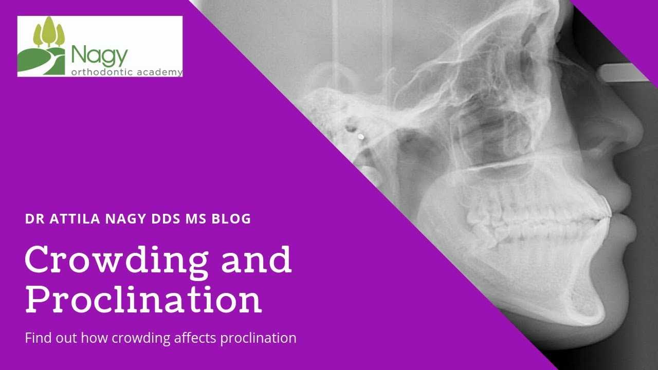Evaluating crowding and proclination | Orthodontic Matters 27