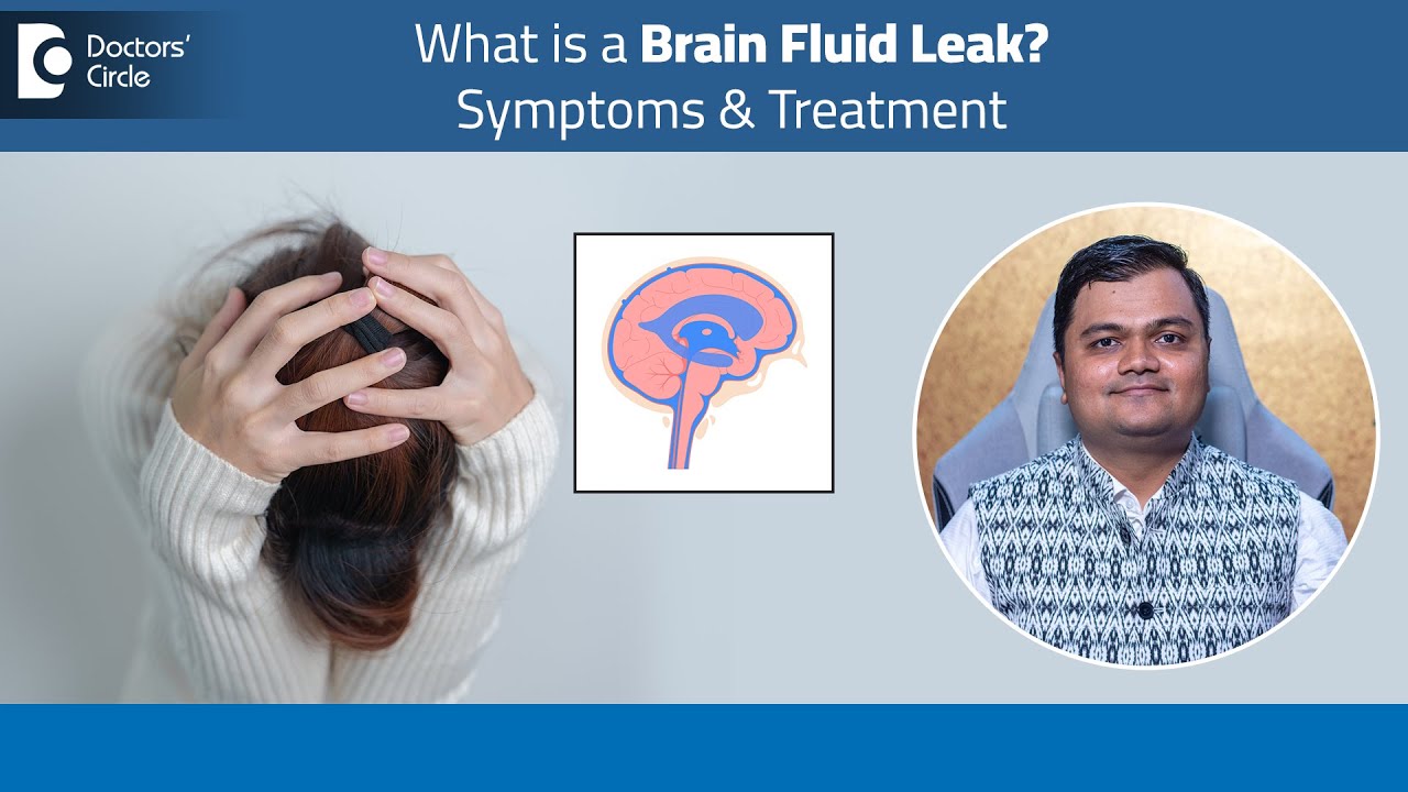 How to know if I have Brain Fluid leak?|Cerebrospinal Fluid Leak-Dr.Advait Kulkarni |Doctors' Circle