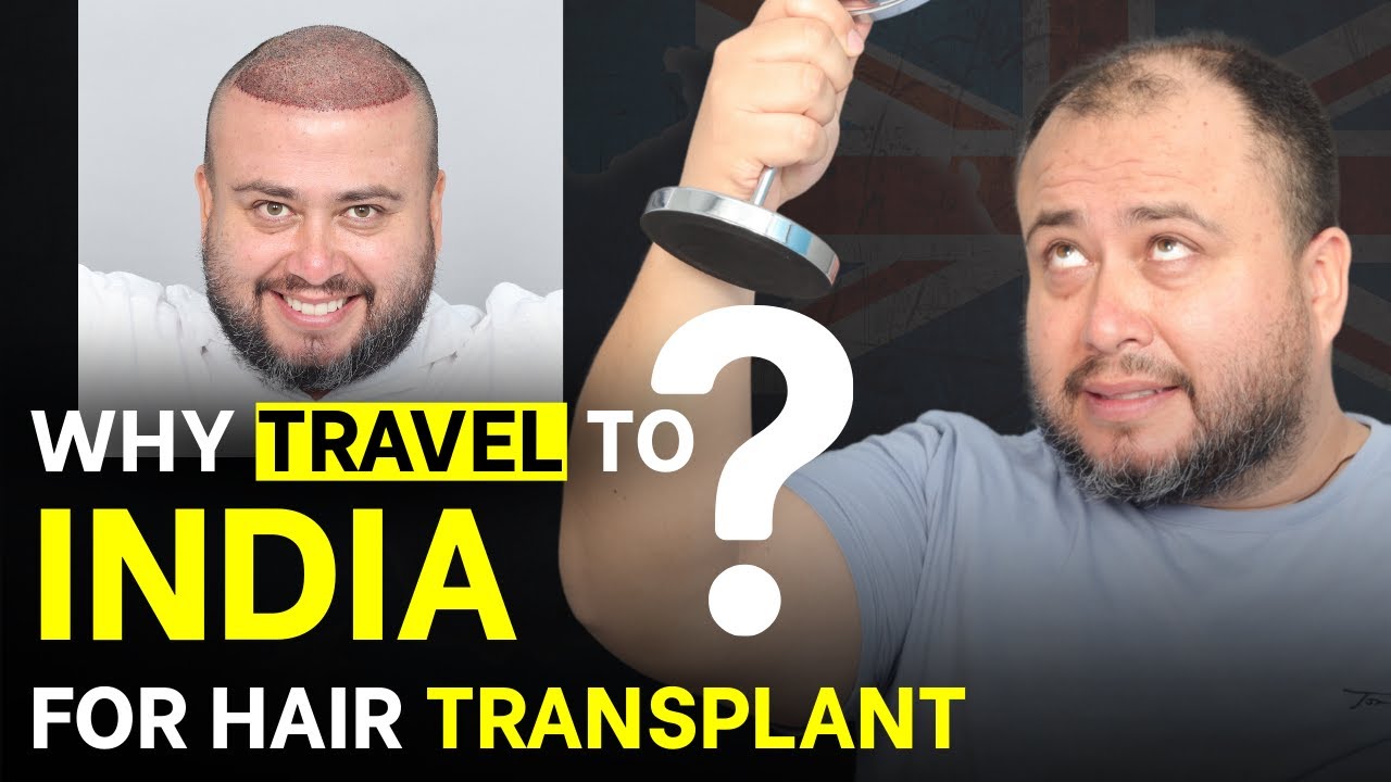 Hair Transplant in Hyderabad (HX-KPZE) | Best Results & Cost of Hair Transplant in Hyderabad