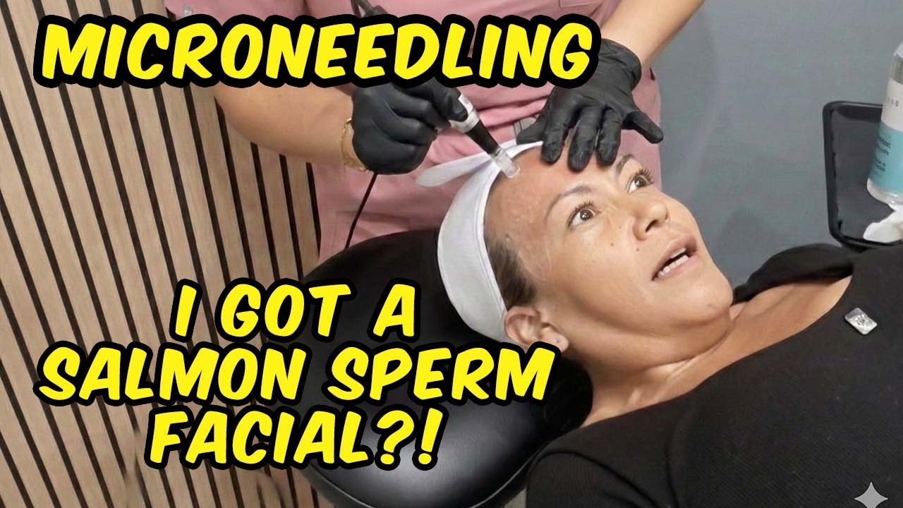 I Tried the Trending SALMON SPERM Facial?! 🐟 MicroNeedling + VAMP Treatment at Skintique