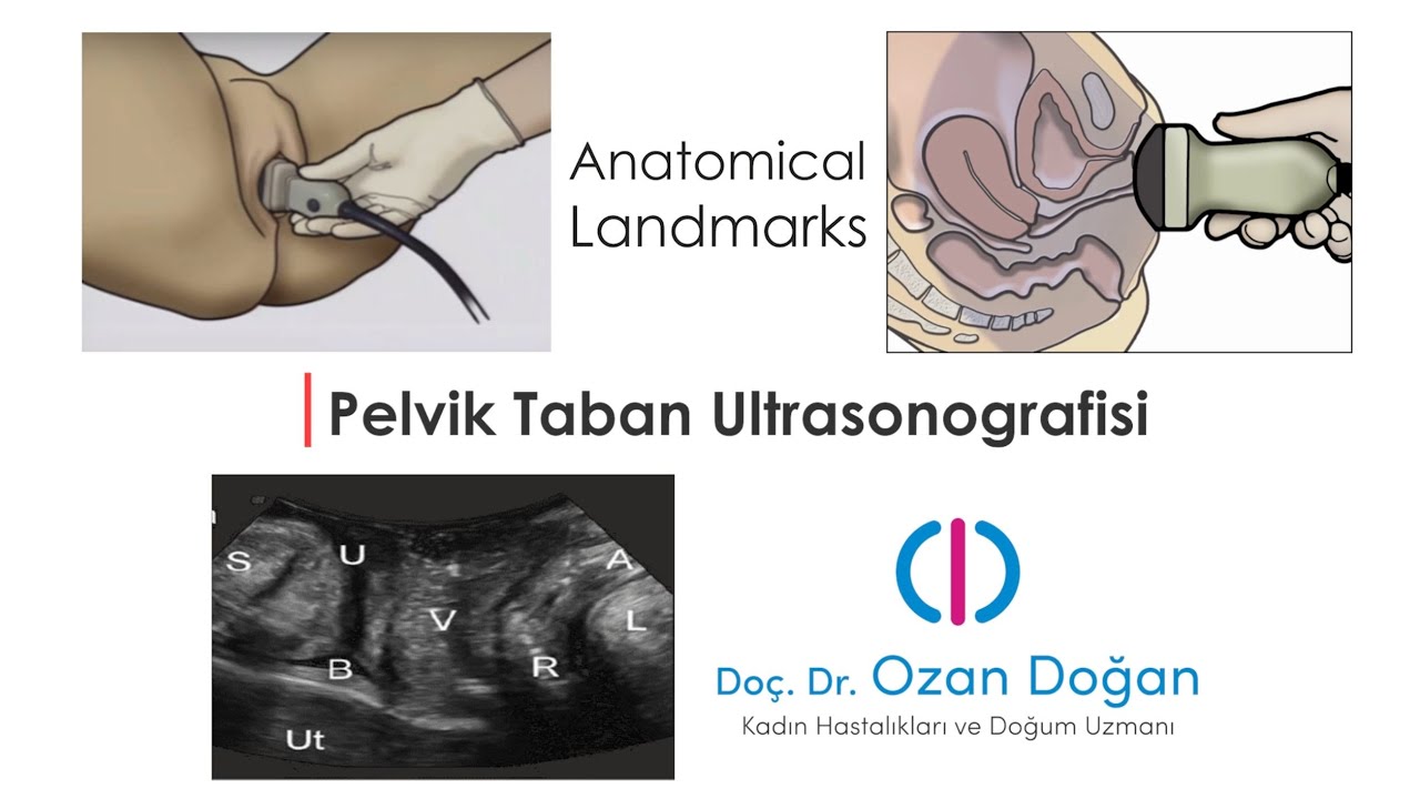 Pelvik Taban Ultrasonografisi Anatomical Landmarks