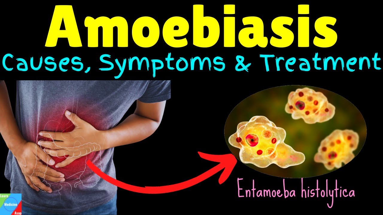 Amoebiasis | Amebiasis | Amoebic Dysentery &ndash; Symptoms, Causes, Treatment, Complications, Preventions