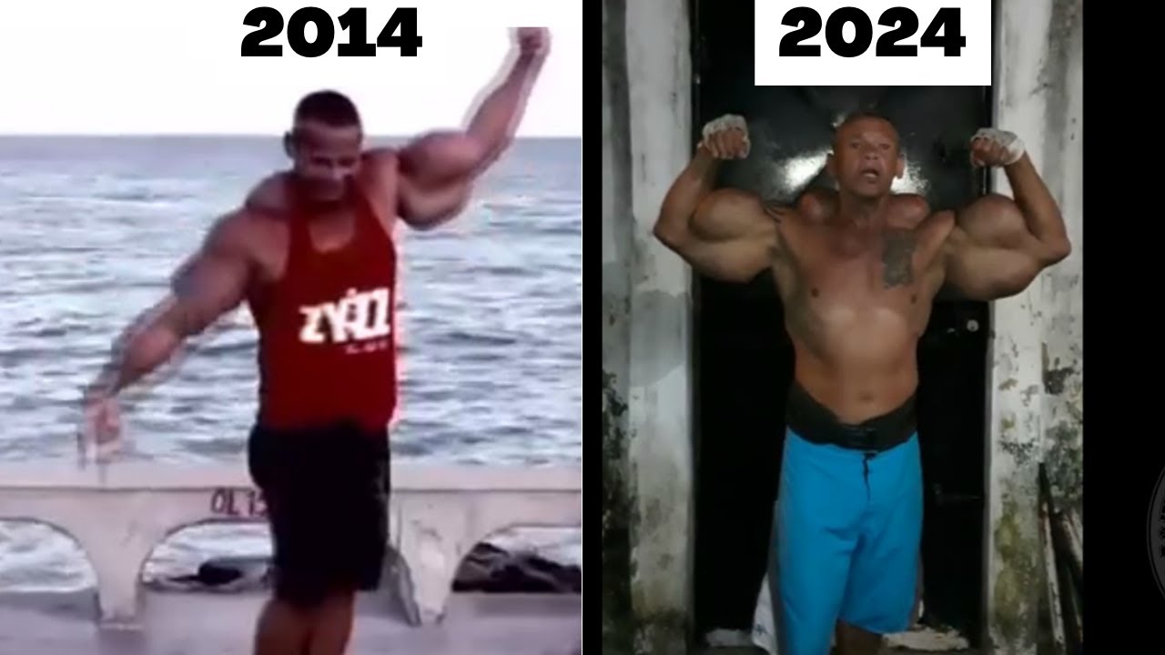 Troll Maromba - Arlindo anomalia o Homem mais vaidoso do Brasil 2024