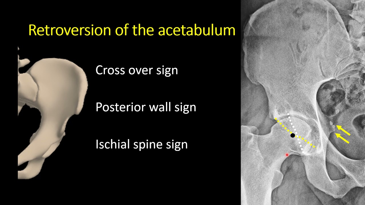 FAI Radiology - AAAZEEM